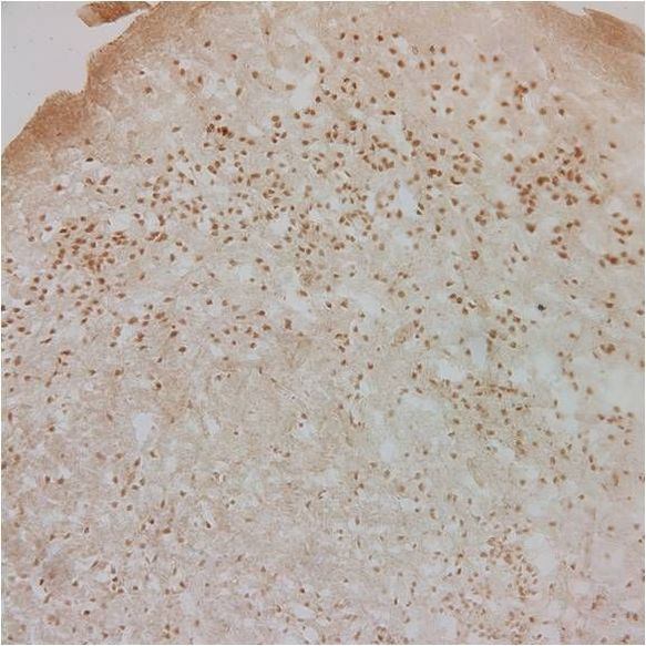 Glucocorticoid Receptor Antibody in Immunohistochemistry (IHC)