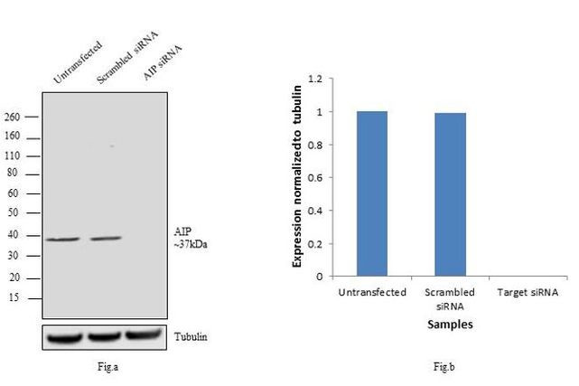 AIP Antibody