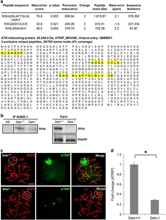 ATRIP Antibody in Western Blot, Immunohistochemistry (WB, IHC)