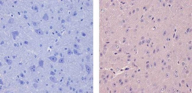 CaMKI Antibody in Immunohistochemistry (Paraffin) (IHC (P))