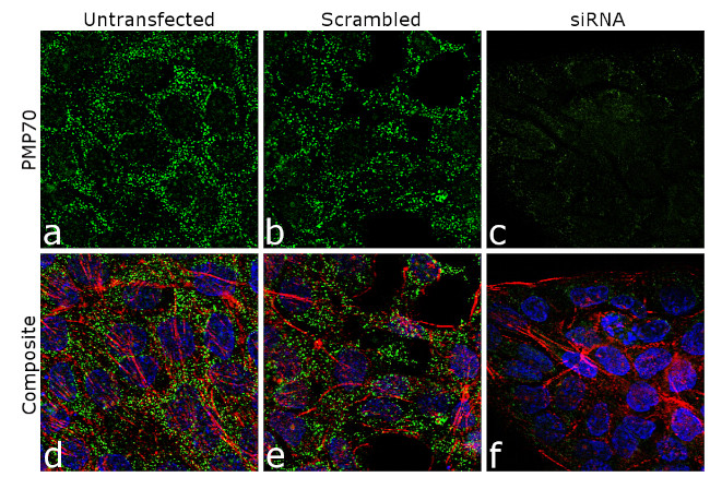 PMP70 Antibody