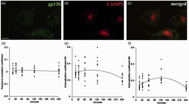 LAMP2 Antibody in Immunocytochemistry (ICC/IF)