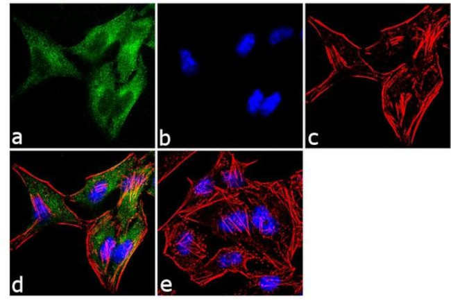 Dynamin 2 Antibody in Immunocytochemistry (ICC/IF)