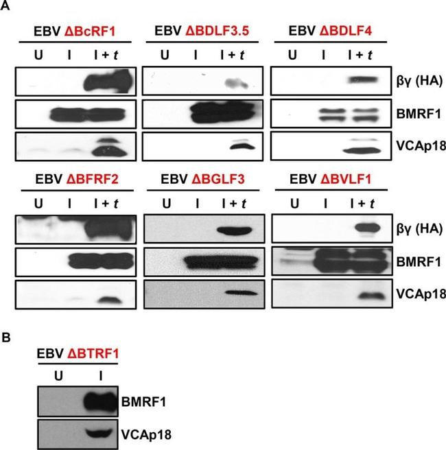Epstein Barr Virus p18 Antibody in Western Blot (WB)