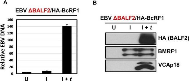 Epstein Barr Virus p18 Antibody in Western Blot (WB)