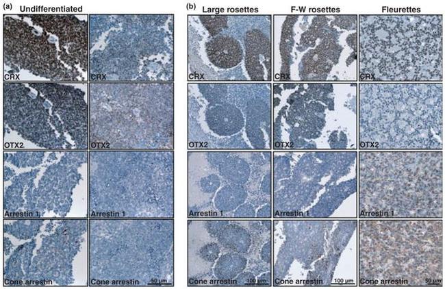 S-arrestin Antibody in Immunohistochemistry (IHC)