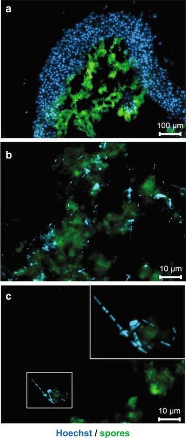 Clostridia Antibody in Immunocytochemistry (ICC/IF)