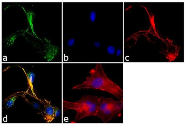 SNAP23 Antibody in Immunocytochemistry (ICC/IF)