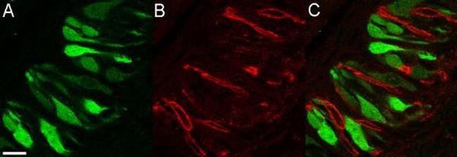 SNAP25 Antibody in Immunohistochemistry (IHC)