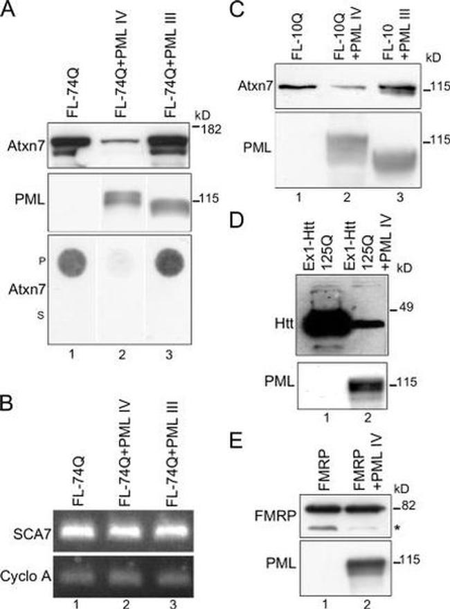 Ataxin 7 Antibody in Western Blot (WB)