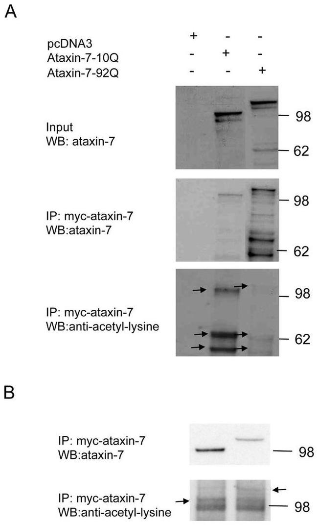 Ataxin 7 Antibody in Western Blot, Immunoprecipitation (WB, IP)