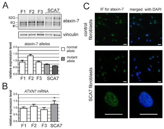 Ataxin 7 Antibody in Immunocytochemistry (ICC/IF)