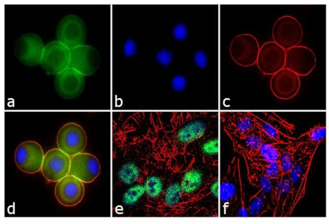 Ataxin 7 Antibody in Immunocytochemistry (ICC/IF)