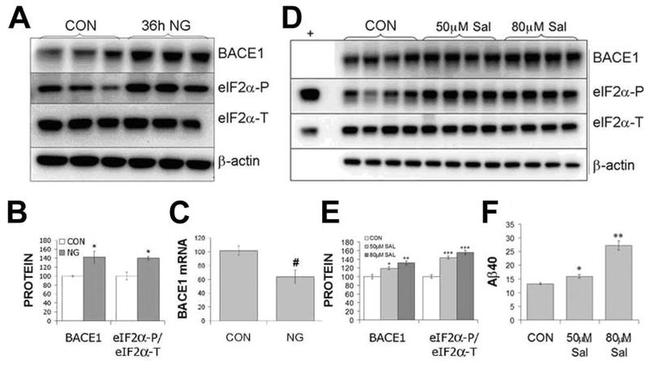 BACE1 Antibody in Western Blot (WB)