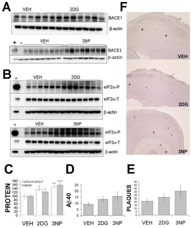 BACE1 Antibody in Western Blot (WB)