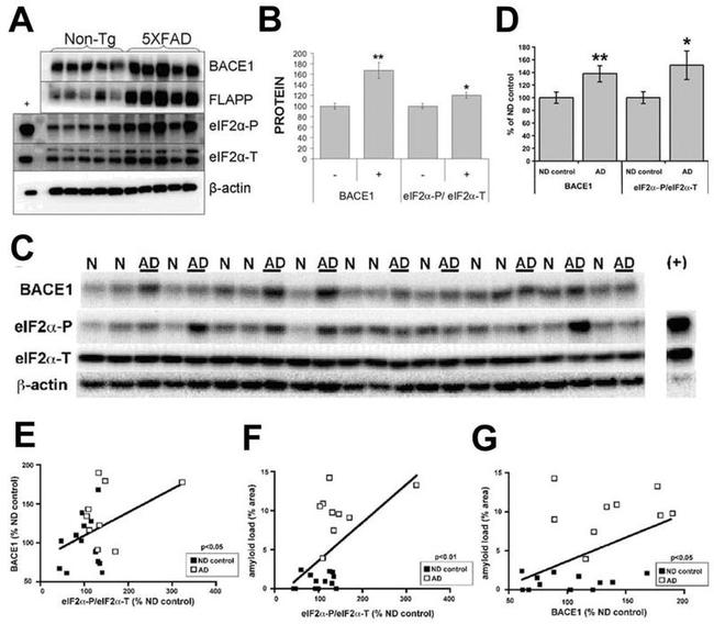 BACE1 Antibody in Western Blot (WB)