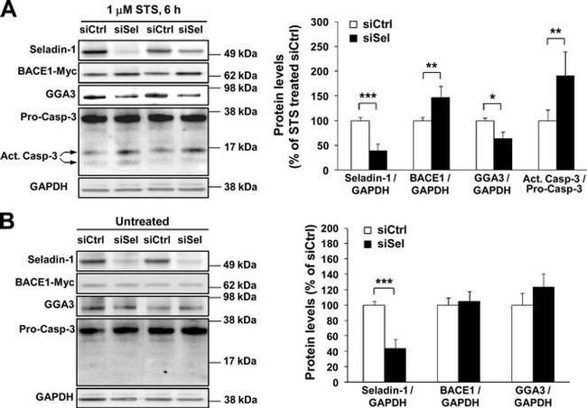 BACE1 Antibody in Western Blot (WB)