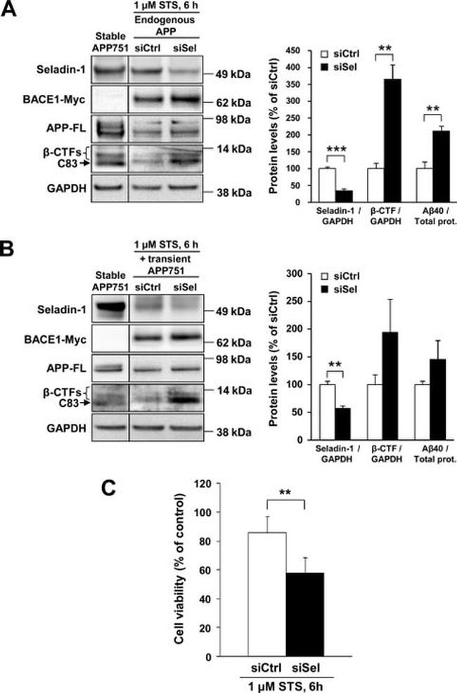 BACE1 Antibody in Western Blot (WB)