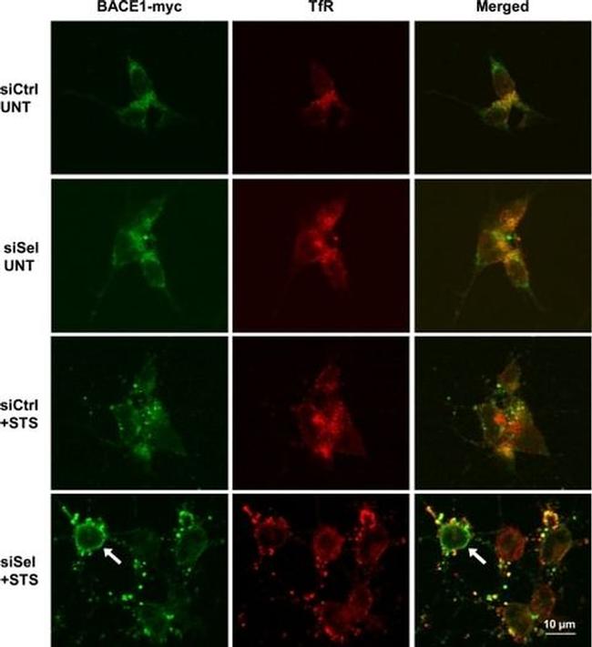 BACE1 Antibody in Immunocytochemistry (ICC/IF)