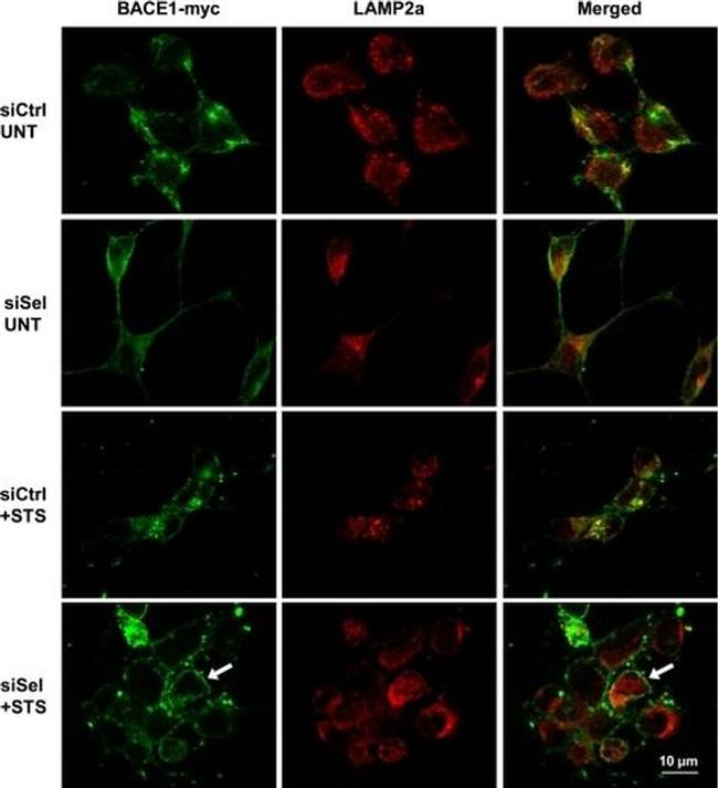 BACE1 Antibody in Immunocytochemistry (ICC/IF)