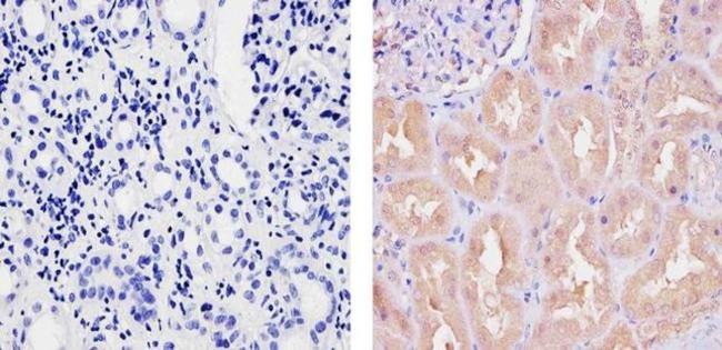 Ubiquilin 1 Antibody in Immunohistochemistry (Paraffin) (IHC (P))