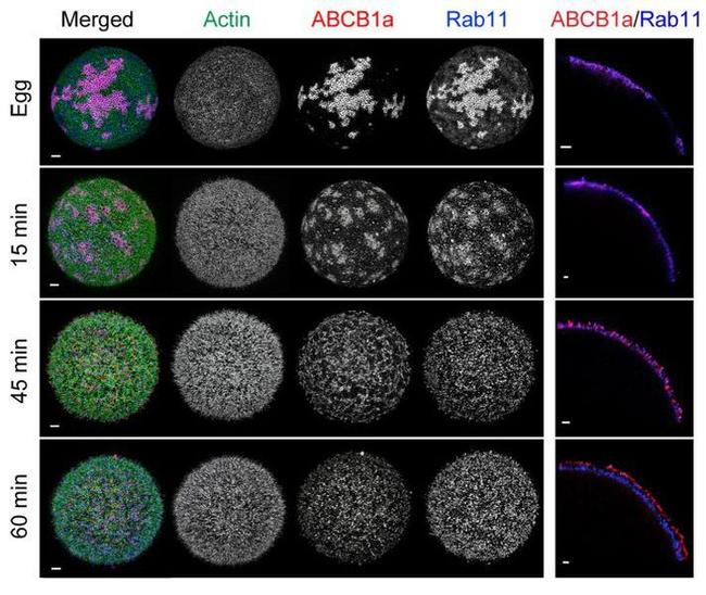 RAB11B Antibody in Immunohistochemistry (IHC)