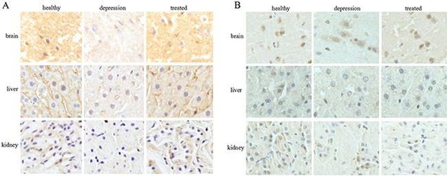 TPH1 Antibody in Immunohistochemistry (Paraffin) (IHC (P))