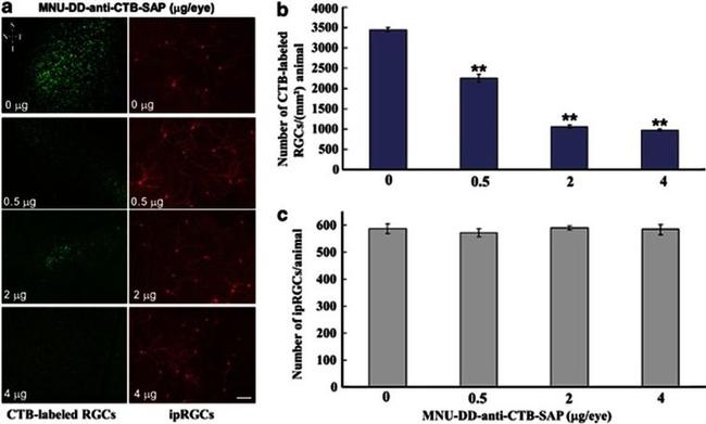 Opsin 4 Antibody in Immunohistochemistry (IHC)