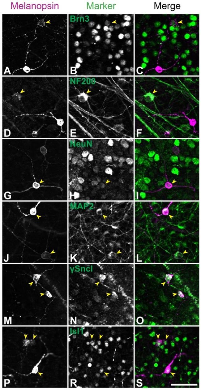 Opsin 4 Antibody in Immunohistochemistry (IHC)