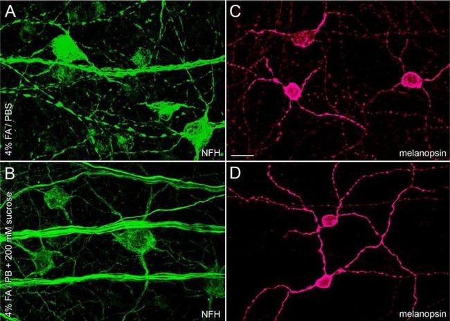 Opsin 4 Antibody in Immunohistochemistry (IHC)