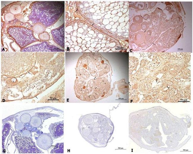 FOXL2 Antibody in Immunohistochemistry (Paraffin) (IHC (P))