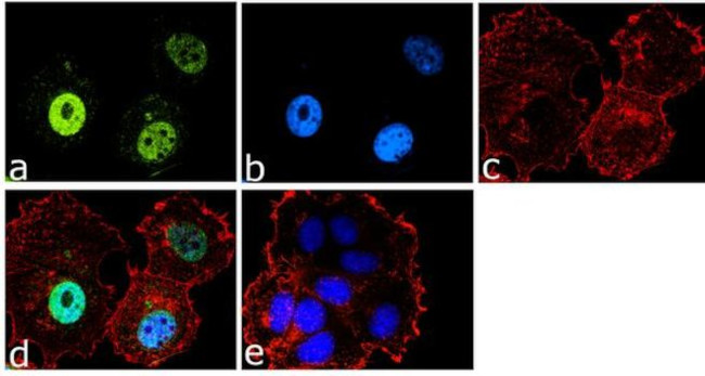 FOXO3A Antibody in Immunocytochemistry (ICC/IF)