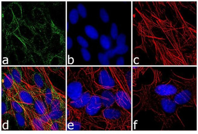 RARA Antibody in Immunocytochemistry (ICC/IF)