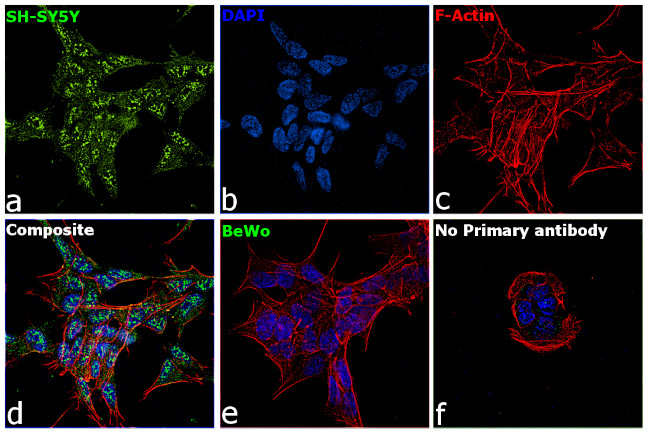 RARB Antibody in Immunocytochemistry (ICC/IF)