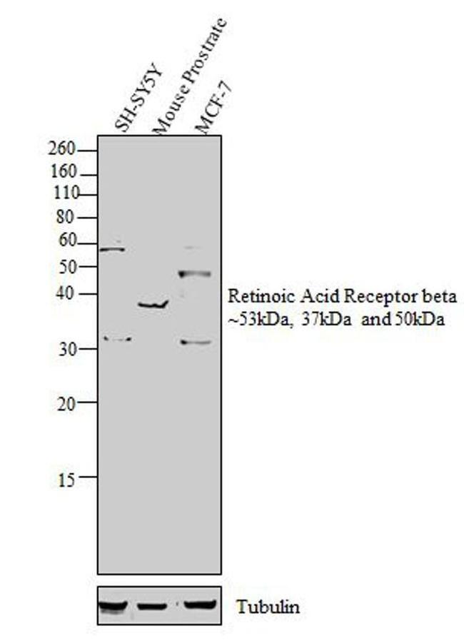 RARB Antibody in Western Blot (WB)