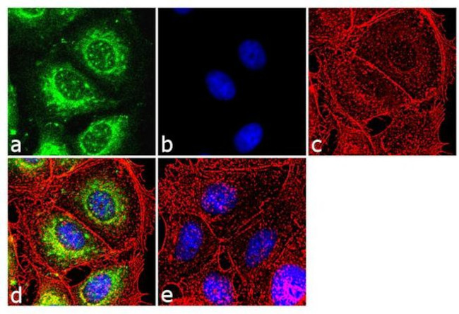 RARB Antibody in Immunocytochemistry (ICC/IF)