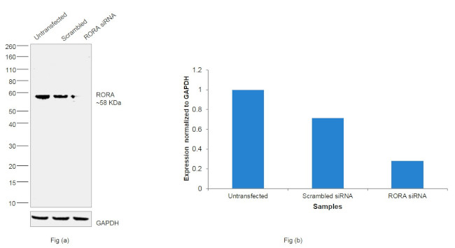 RORA Antibody