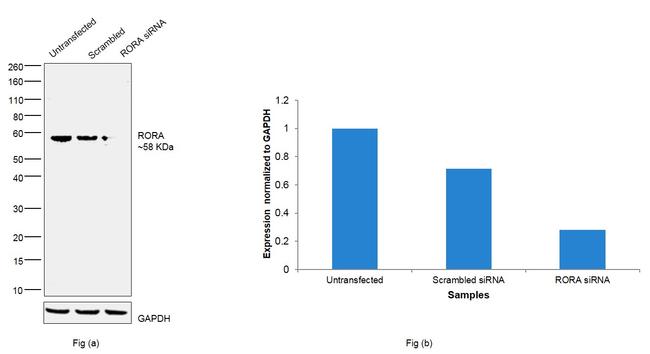 RORA Antibody in Western Blot (WB)