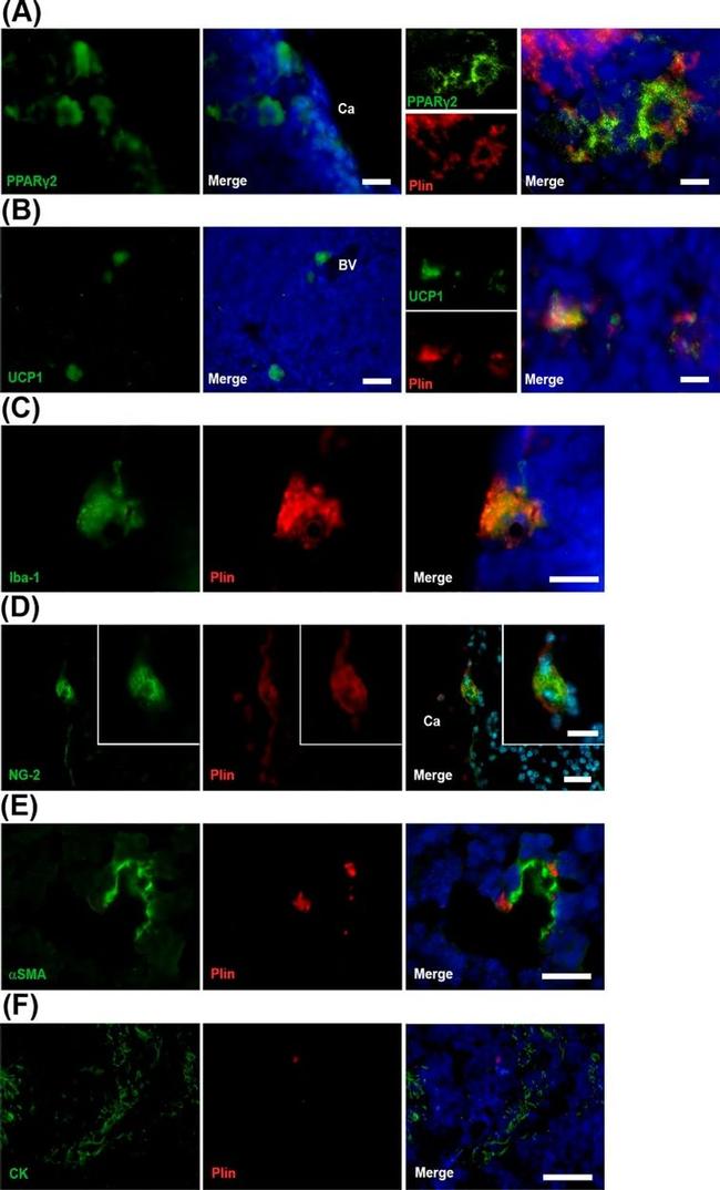 PPAR gamma-2 Antibody in Immunocytochemistry (ICC/IF)