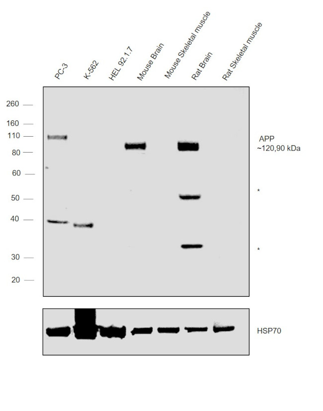 Amyloid Precursor Protein Antibody