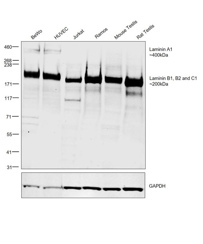 Laminin A/B Antibody in Western Blot (WB)