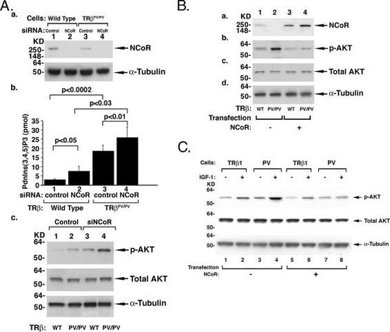 NCoR1 Antibody in Western Blot (WB)