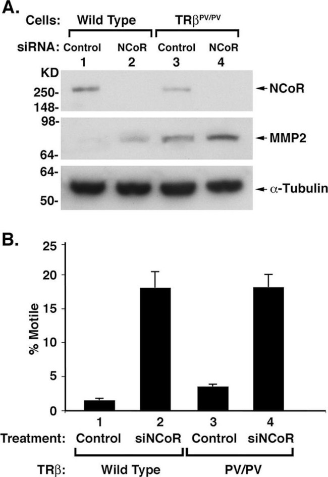 NCoR1 Antibody in Western Blot (WB)