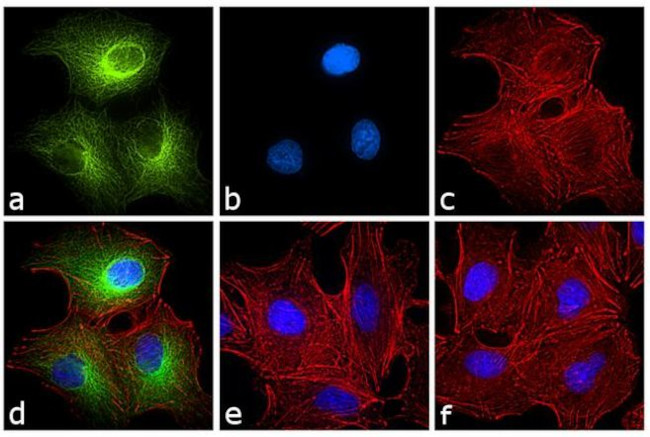 Rat IgG2a Secondary Antibody in Immunocytochemistry (ICC/IF)