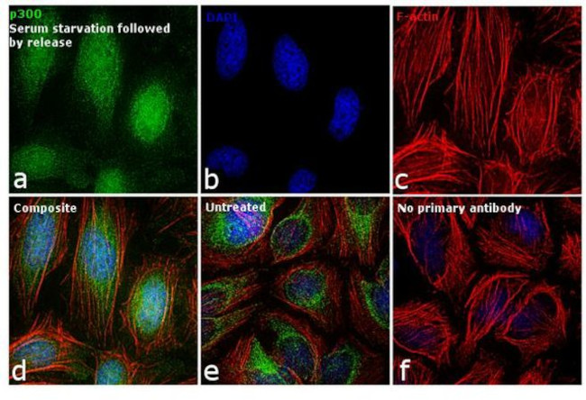 p300 Antibody in Immunocytochemistry (ICC/IF)