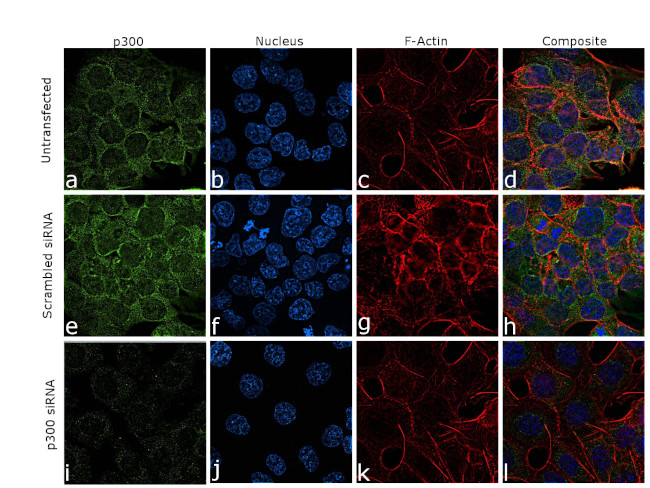 p300 Antibody in Immunocytochemistry (ICC/IF)