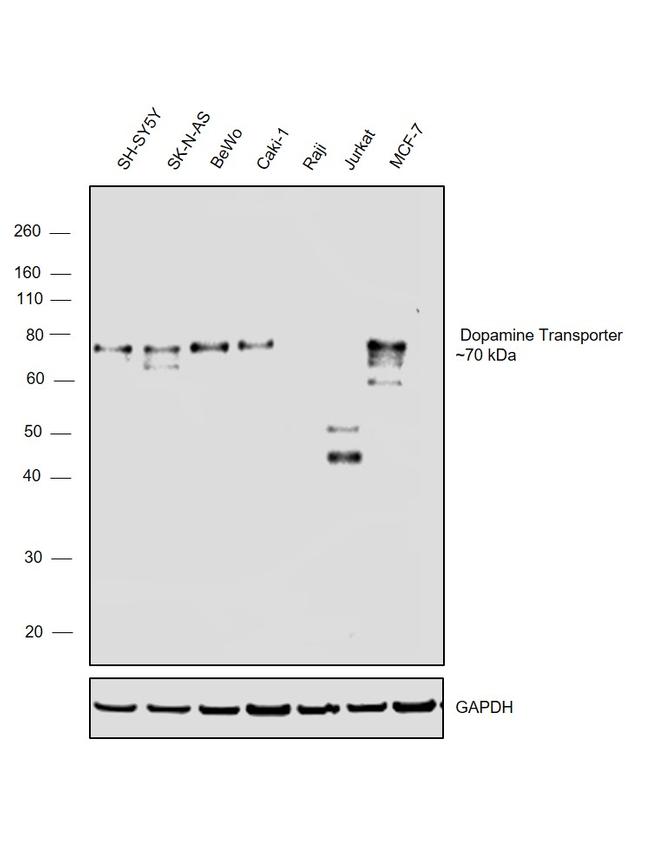 Dopamine Transporter Antibody in Western Blot (WB)