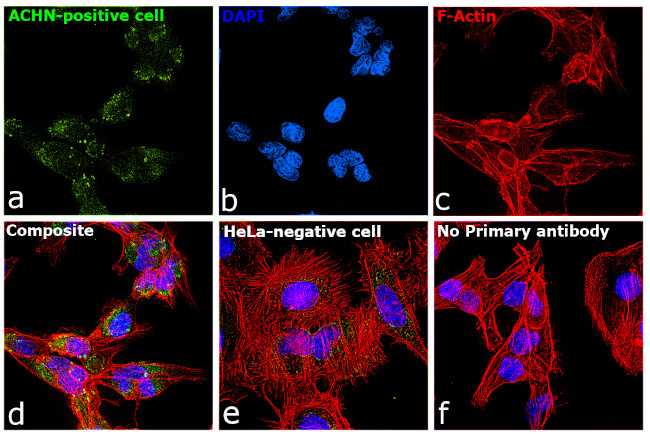 TIM-1 Antibody in Immunocytochemistry (ICC/IF)