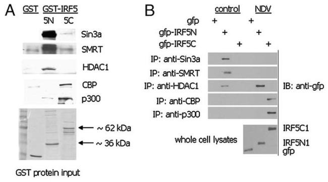 SIN3A Antibody in Western Blot (WB)