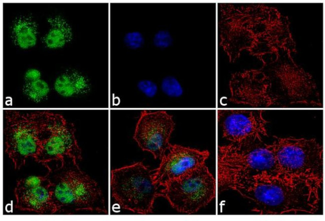 DNMT1 Antibody in Immunocytochemistry (ICC/IF)